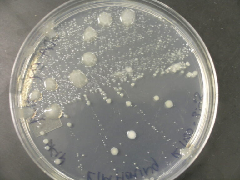 A Petri dish with bacterial colonies of various sizes on an agar medium, with handwritten labels on the side.