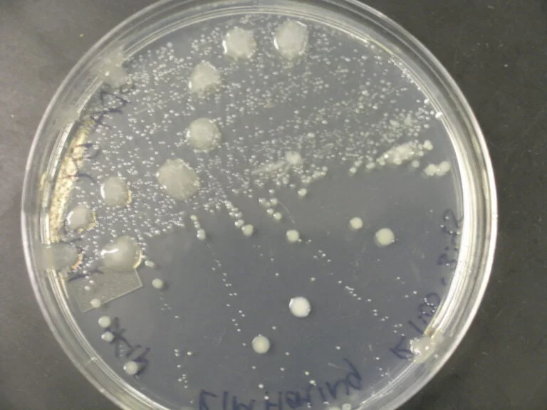 A Petri dish with bacterial colonies of various sizes on an agar medium, with handwritten labels on the side.
