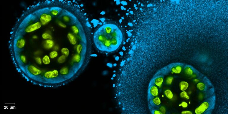 Fluorescence microscopy image showing three cells with green fluorescent nuclei against a dark background, with a scale bar indicating 20 micrometers.