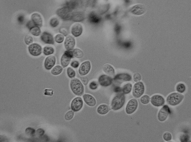 Microscopic view of a cluster of yeast cells in various stages of budding.